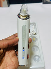 Vacuum Blackhead Remover | Electric Facial Cleanser & Pore Cleaner | Rechargeable Suction Tool for Deep Skin Cleansing